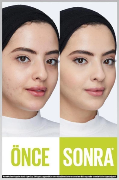 Maybelline New York Super Stay 30h Kapatıcı - 20 Sand - 5