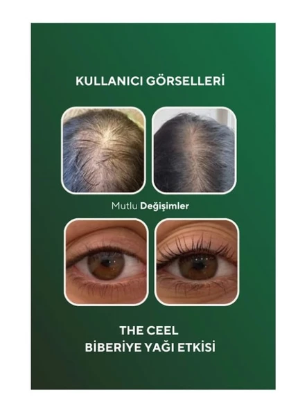 The Ceel Biberiye Yağı Complexi Sac Dokulmesi ve Asiri Yipranmis Saclar icin Biotin Özlü Saç Bakımı 50 ML - 7