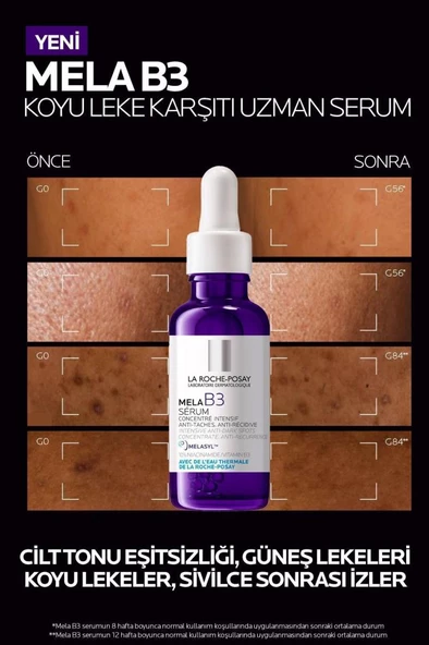 La Roche Posay Mela B3 Koyu Leke Karşıtı Serum 30ml - 6