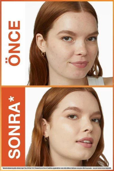 Maybelline New York Super Stay 24H Skin Tint 40 Fondöten - 5