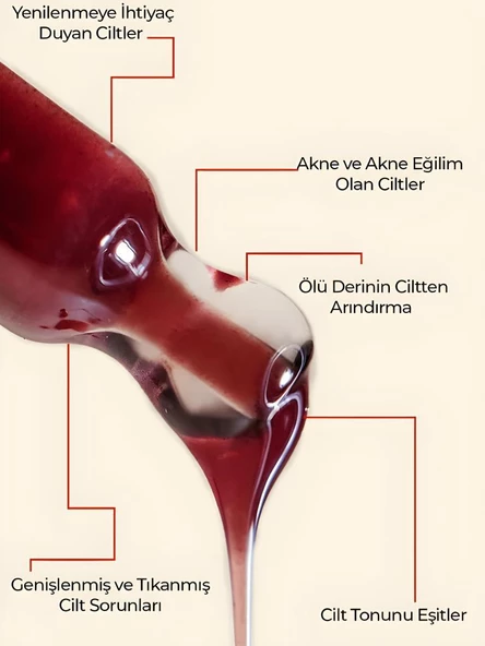 Ronna Beauty Akneli Cilt Düzenleyici Red Peeling Serum 30 ml AHA 15%+BHA 2% pH3.8 - 3