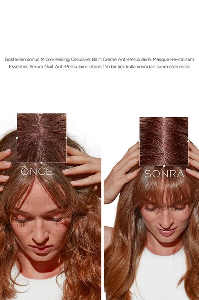 Kerastase Symbiose Kepek Karşıtı Yatıştırıcı Saç kremi 200 ml - Resim 8