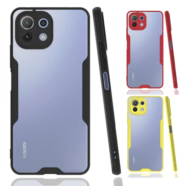 Xiaomi Mi 11 Lite Kılıf Platin Matte Silikon Arka Kapak
