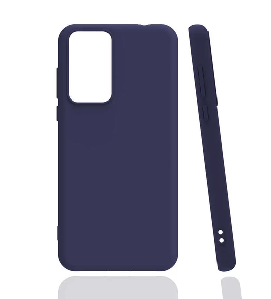 Xiaomi Mi 12T Pro Kılıf Zore Biye Silikon Kılıf - 4