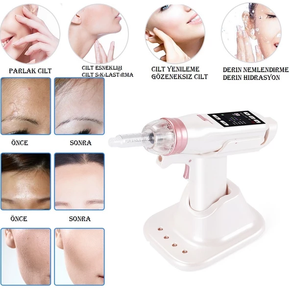 Yeni Nesil Mezoterapi Tabancası Yüz Sıkılaştırma Saç Yenileme Cilt İz Kırışıklık Leke Giderme Cihazı - Resim 4