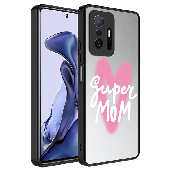 Xiaomi Mi 11T 5G Kılıf Aynalı Desenli Kamera Korumalı Parlak Zore Mirror Kılıf - Resim 2