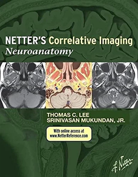 Netter’s Correlative Imaging: Neuroanatomy Thomas C. Lee MD