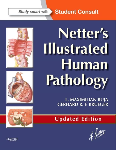 Netter's Illustrated Human Pathology Updated Edition L. Maximilian Buja