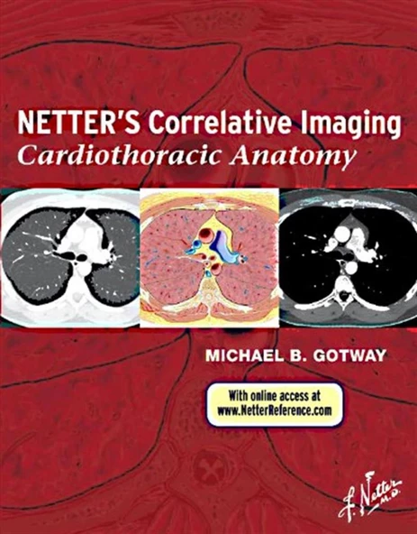 Netter’s Correlative Imaging: Cardiothoracic Anatomy M.D. Gotway, Michael B.