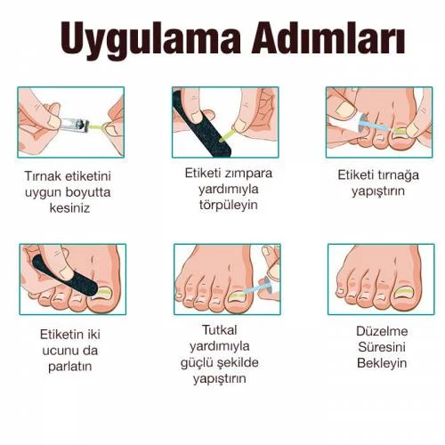 Polham 24 Parça Batık Tırnak Önletici, Profesyonel Takma Tırnak Bakım ve Onarım Pedikür Seti - 5