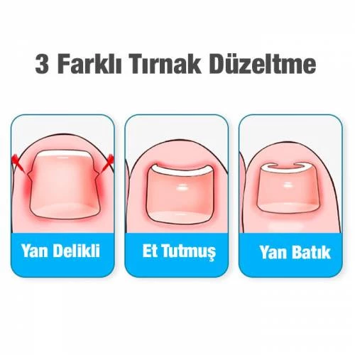 Polham 24 Parça Batık Tırnak Önletici, Profesyonel Takma Tırnak Bakım ve Onarım Pedikür Seti - 3