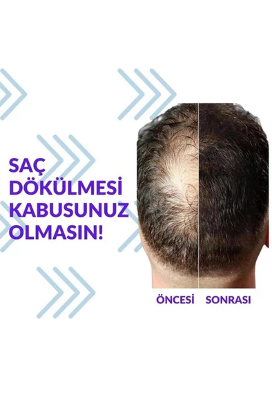 Pak Darou Minioxidil Minoxidil %5 Minoksil Pak Darou - 1