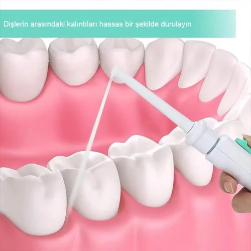 Polham Musluk Aparatlı Ağız İçi Temizleme Aleti, Sulu Ağız Duşu Aparatı, Diş ve Damak Temizleyici - 4