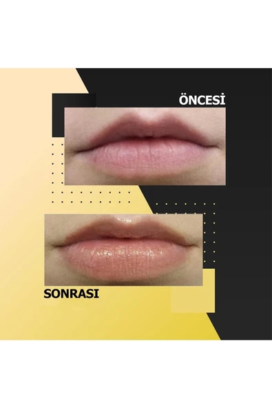 Too Be Beauty Antiaging & Volumizer Lip Care 24 K Pure Gold Dudak Bakım Ürünü - 5