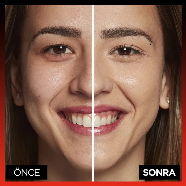 L'Oréal Paris Infaillible 24H Tüm Yüze Uygulanabilir Kapatıcı - 330 Pecan - 6