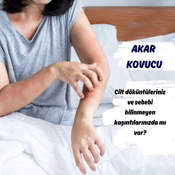 MITE END- Akar Kovucu Sprey - 3