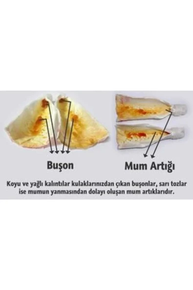 Trade Bazaar Doğal Kulak Temizleme Mumu 2 Adet - 4