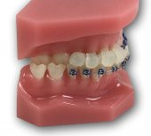 ORTODONTİ MUMU - DİŞ TELİ MUMU - ORTODONTİK WAX - 1
