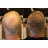 Fixplant 2 Şişe 56 Gr. Saç Gürleştirici Toz - 2