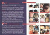 Fit Care Saç Besleyici Losyon - 3