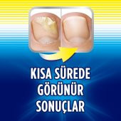 Scholl Tırnak Mantarı Tedavi 3.8 ML - 3