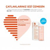 Bio Oil Çatlak ve Leke İçin Bakım Yağı 60 ml Çatlak Yağı - 4