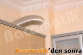 Bacamatik Baca Klapesi Folyo Bant ve Aspiratör Borusu Set - 5