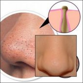 Siyah Nokta Giderici Burun Bandı 6lı - 1