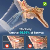 Morfone Elektrikli Etkili ve Güvenli Kulak Temizleme Kiti - Gri - 2