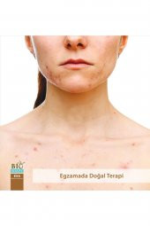 2 Adet Biosoapy Doğal Welness Exa Egzama Sabunu 100 Gr / Adet (egzamada Doğal Terapi) EXA - 5