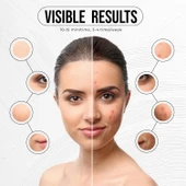 PureRadiance Yüz için LED Kırmızı Işık Terapi Maskesi, 7 Renk Modu - 4