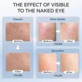 EVFOFO Yüz için Kırmızı ve Mavi Kırmızı Işık Terapi Maskesi - 4