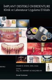 İmplant Destekli Overdenture Klinik Ve - Palme Yay - 1