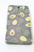 Xiaomi Redmi Note 8 Pro Uyumlu Kamera Korumalı Avokado Kılıf Özel Tasarım Tuşları Renkli Hux Kapak - 2