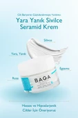 BAGA Yara Yanık Sivilce Seramid Krem - 1