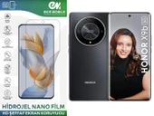 Honor X9b ile Uyumlu Hidrojel Ekran Koruyucu Film HD-ŞEFFAF(Tempered Cam Değildir!) - 1