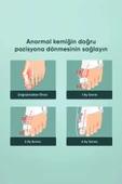Ayak Baş Parmak Kemik Düzeltici Halluks Valgus Ayak Bakımı Bunyon Koruyucu Gece Ateli - 3