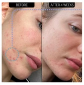 THE INKEY LIST Blemish Clearing Moisturizer 2% NovoRetin - Nemlendirici Gece Kremi 50 ml - 2