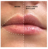 THE INKEY LIST Tripeptide Plumping Lip Balm Berry - Dolgunlaştırıcı Dudak Balmı 10 ml - 4