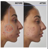 THE INKEY LIST Scar, mark and wrinkle solution with 1% retinol - Yüz Serumu 30 ml - 2