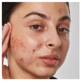THE INKEY LIST Scar, mark and wrinkle solution with 1% retinol - Yüz Serumu 30 ml - 3