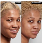 THE INKEY LIST NIACINAMIDE - Serum 30 ml thumbnail 2