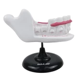 YARIM ÇENE DİŞ MODELİ thumbnail 1