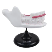 YARIM ÇENE DİŞ MODELİ thumbnail 2