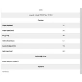 Form Metal 32159 Karsan 6 Kanal 11 Diş 72336117 Marş Dişlisi - 2