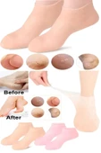 Silikon Ayak Bakım Çorabı Topuk Çorabı Nemlendirici Jel Çorap Çatlak Önleyici Ölü Deri Atıcı Çorap - 1