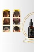 Erkek Saç Çıkarmaya Yardımcı Serum Sakal Çıkarmaya Yardımcı Serum & Bıyık Çıkarmaya Yardımcı Serum - 2