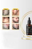 Erkek Saç Çıkarmaya Yardımcı Serum Sakal Çıkarmaya Yardımcı Serum & Bıyık Çıkarmaya Yardımcı Serum - 3