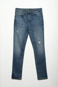 Erkek Yırtık Detay Likralı Skinny Fit Açık Mavi Jean Pantolon - 2