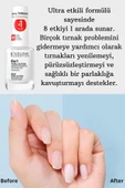 Eveline Cosmetics Total Action 8 In 1 Intensive Nail Conditioner 12 ml thumbnail 4